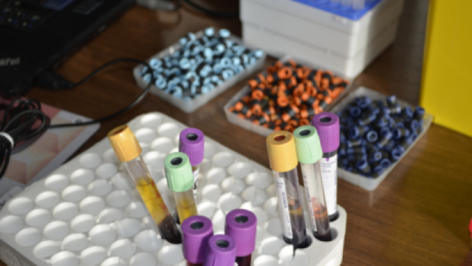 Jēkabpilī septembrī uzsāks gremošanas sistēmas slimību profilakses pētījumu GISTAR