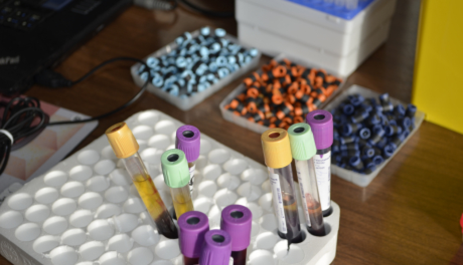 Jēkabpilī septembrī uzsāks gremošanas sistēmas slimību profilakses pētījumu GISTAR